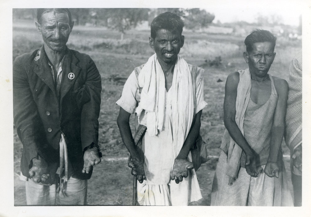 Lepers At Jagadhri.