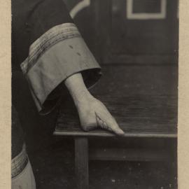 A Chinese Woman's Foot That Has Been Bound.